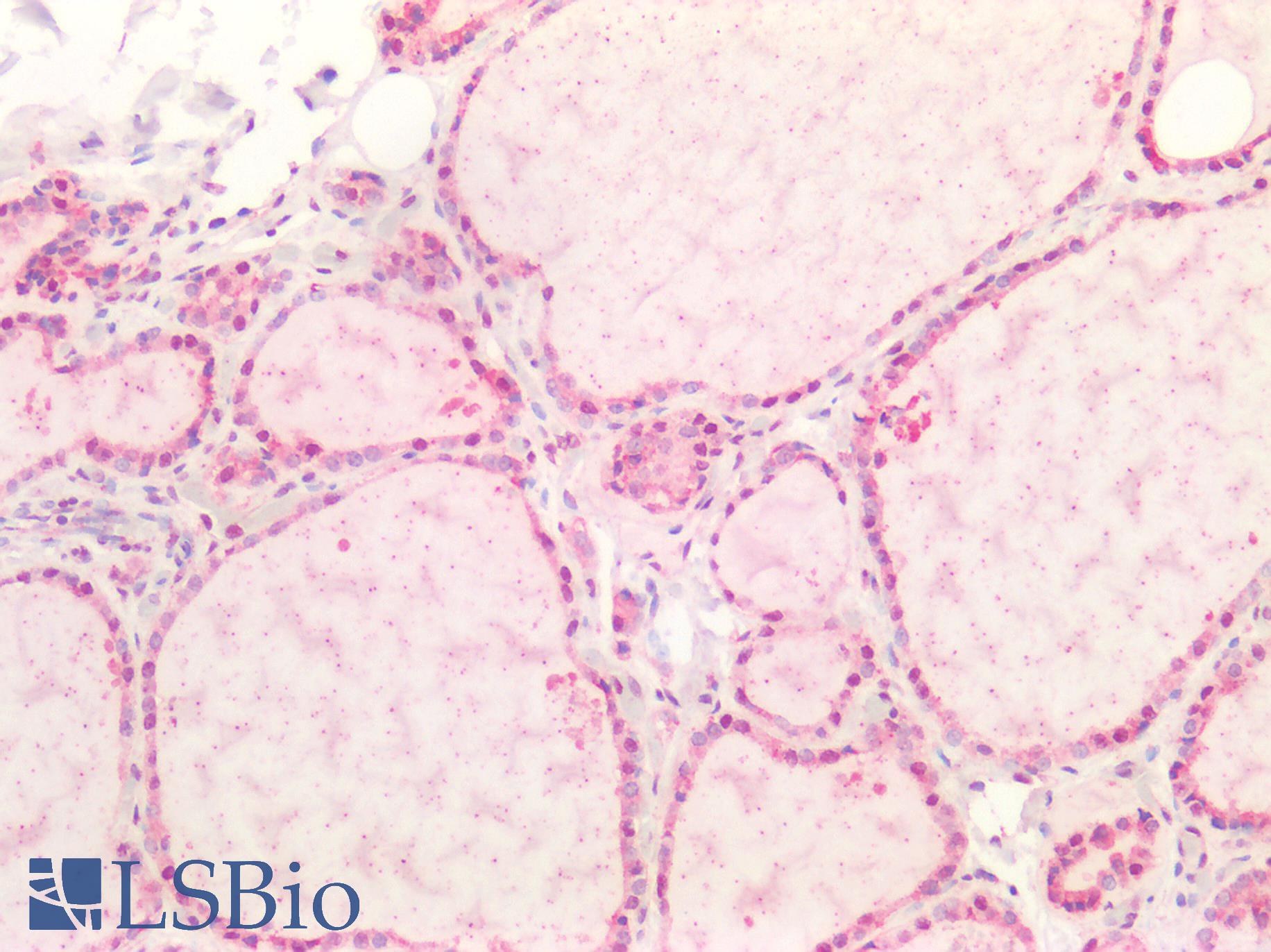 CASP9 / Caspase 9 Antibody - Human Thyroid: Formalin-Fixed, Paraffin-Embedded (FFPE)