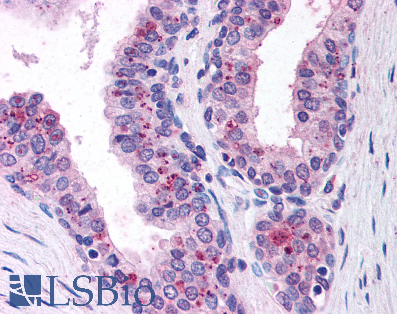 CASP9 / Caspase 9 Antibody - Anti-Caspase 9 antibody IHC of human prostate. Immunohistochemistry of formalin-fixed, paraffin-embedded tissue after heat-induced antigen retrieval. Antibody dilution 1:50.