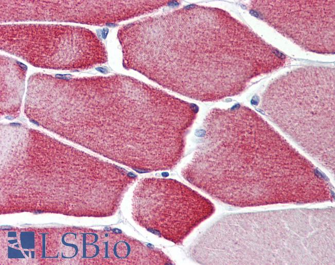 CASQ2 / Calsequestrin 2 Antibody - Anti-CASQ2 / Calsequestrin antibody IHC of human skeletal muscle. Immunohistochemistry of formalin-fixed, paraffin-embedded tissue after heat-induced antigen retrieval. Antibody concentration 5 ug/ml.