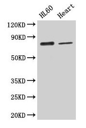 CAST / Calpastatin Antibody - Western Blot Positive WB detected in: HL60 whole cell lysate All lanes: CAST antibody at 2.6µg/ml Secondary Goat polyclonal to rabbit IgG at 1/50000 dilution Predicted band size: 77, 76, 64, 72, 82, 85, 83, 75, 81 kDa Observed band size: 77 kDa