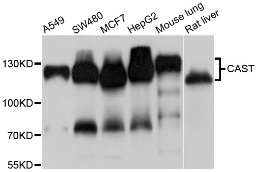 CAST / Calpastatin Antibody - Western blot analysis of extracts of various cell lines.