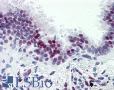 CASZ1 Antibody - Anti-CASZ1 antibody IHC of human lung. Immunohistochemistry of formalin-fixed, paraffin-embedded tissue after heat-induced antigen retrieval. Antibody concentration 5 ug/ml.