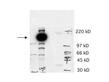 CASZ1 Antibody - Anti-hCas5 Antibody - Western Blot. Western blot of affinity purified anti-hCas5 antibody shows detection of a band ~125 kD in size corresponding to hCas5 (arrowhead). Lane 1 contains a lysate from AS cells transfected with empty vector. Lane 2 contains lysate from AS cells transfected with hCas5 (predicted MW 125 kD). Lane 3 contains lysate from BE2 cells that have been shown to contain a high level of hCas mRNA (as tested by Northern blot). Lane 4 contains lysate from human muscle tissue that also shows high levels of hCas mRNA. Specific band reactivity is effectively competed when the antibody is pre-incubated with the immunizing peptide (data not shown). Personal Communication. Carol Thiele, NCI, Bethesda, MD.