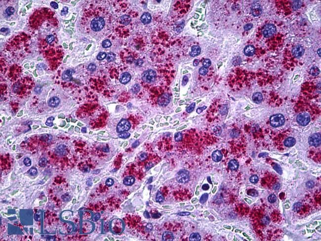 CAT / Catalase Antibody - Anti-Catalase antibody IHC of human liver. Immunohistochemistry of formalin-fixed, paraffin-embedded tissue after heat-induced antigen retrieval. Antibody dilution 1:100.