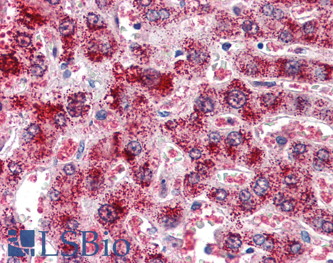 CAT / Catalase Antibody - Anti-Catalase antibody IHC of human liver. Immunohistochemistry of formalin-fixed, paraffin-embedded tissue after heat-induced antigen retrieval. Antibody concentration 2 ug/ml.