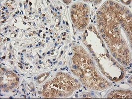 CAT / Catalase Antibody - IHC of paraffin-embedded Human Kidney tissue using anti-CAT mouse monoclonal antibody.