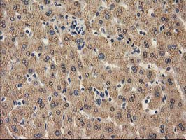 CAT / Catalase Antibody - IHC of paraffin-embedded Human liver tissue using anti-CAT mouse monoclonal antibody.
