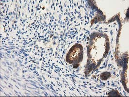 CAT / Catalase Antibody - IHC of paraffin-embedded Human endometrium tissue using anti-CAT mouse monoclonal antibody.