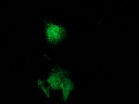 CAT / Catalase Antibody - Anti-CAT mouse monoclonal antibody immunofluorescent staining of COS7 cells transiently transfected by pCMV6-ENTRY CAT.