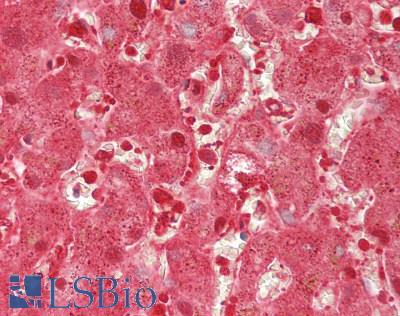 CAT / Catalase Antibody - Human Liver: Formalin-Fixed, Paraffin-Embedded (FFPE)