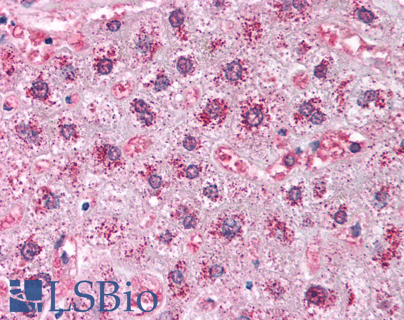 CAT / Catalase Antibody - Anti-Catalase antibody IHC staining of human liver. Immunohistochemistry of formalin-fixed, paraffin-embedded tissue after heat-induced antigen retrieval. Antibody concentration 5 ug/ml.