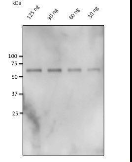 CAT / Catalase Antibody - Western blot of anti-Catalase antibody at 1:500 dilution. 30-125 ug of catalase isolated from bovine liver. Rabbit polyclonal to goat IgG (HRP) at 1:10000 dilution.