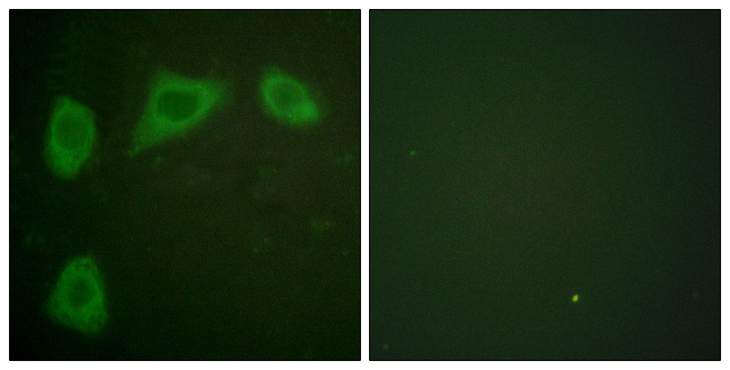 CAV1 / Caveolin 1 Antibody - Immunofluorescence analysis of HUVEC cells, using Caveolin-1 Antibody. The picture on the right is blocked with the synthesized peptide.