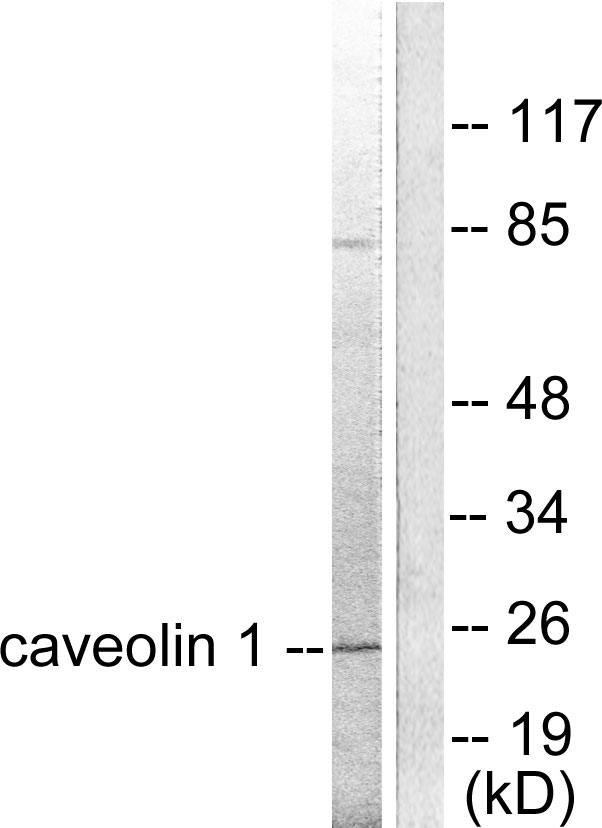 CAV1 / Caveolin 1 Antibody - Western blot analysis of lysates from HUVEC cells, using Caveolin-1 Antibody. The lane on the right is blocked with the synthesized peptide.