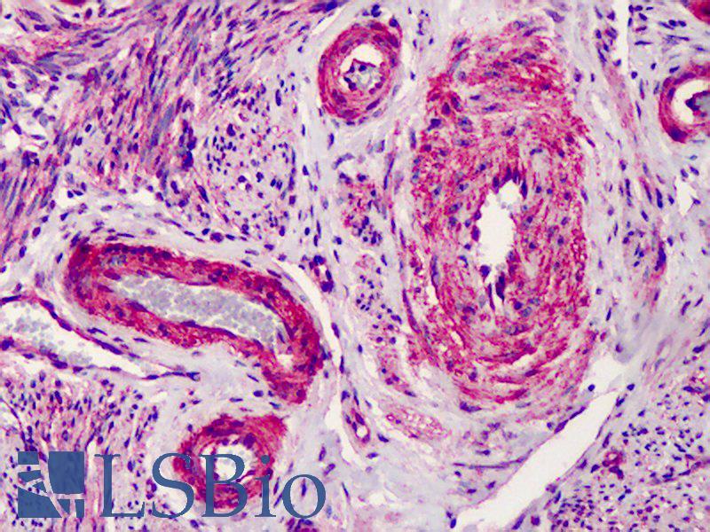 CAV1 / Caveolin 1 Antibody - Anti-CAV1 / Caveolin antibody IHC of human uterus. Immunohistochemistry of formalin-fixed, paraffin-embedded tissue after heat-induced antigen retrieval. Antibody concentration 2.5 ug/ml. This image was taken for the unconjugated form of this product. Other forms have not been tested.