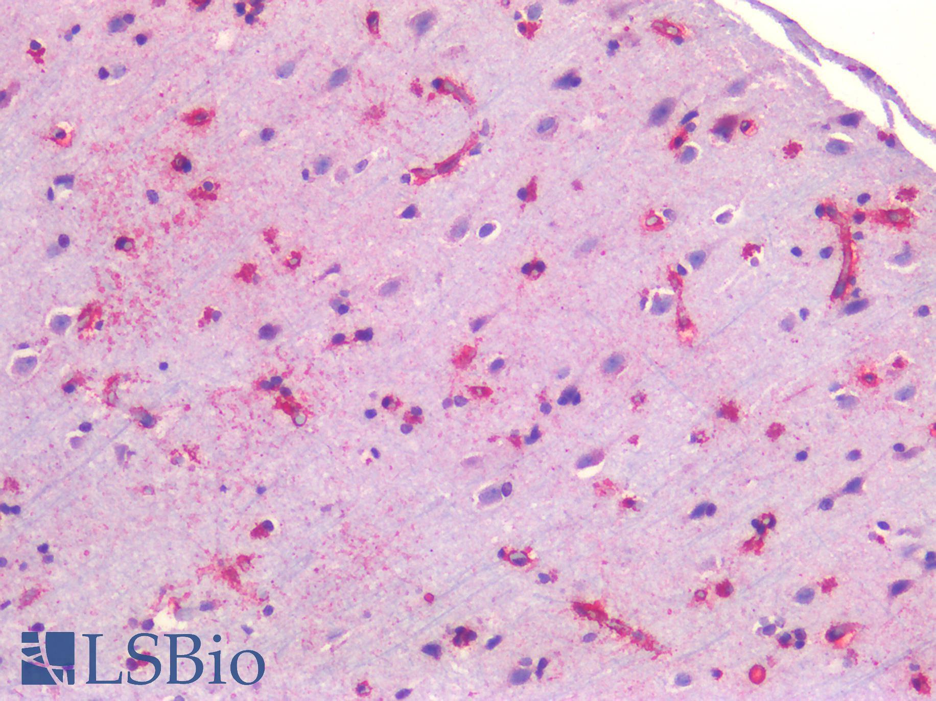 CAV1 / Caveolin 1 Antibody - Human Brain, Cortex: Formalin-Fixed, Paraffin-Embedded (FFPE)