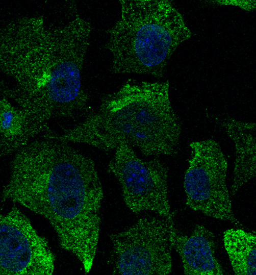 CAV1 / Caveolin 1 Antibody - Immunofluorescence - anti-CAV1 antibody - Caveolae Marker in Hepa1-6 cells at 1:50 dilution. Cells were fixed with 4% of PFA.