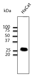 CAV1 / Caveolin 1 Antibody - Anti-CAV1 Ab at 1:1,000 dilution; 100 ug lysate per lane; rabbit polyclonal to goat IgG (HRP) at 1:10,000 dilution;