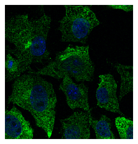 CAV1 / Caveolin 1 Antibody - Immunofluorescence - anti-CAV1 Ab - Caveolae Marker in Hepa1-6 cells at 1:50 dilution; cells were fixed with 4% of PFA;
