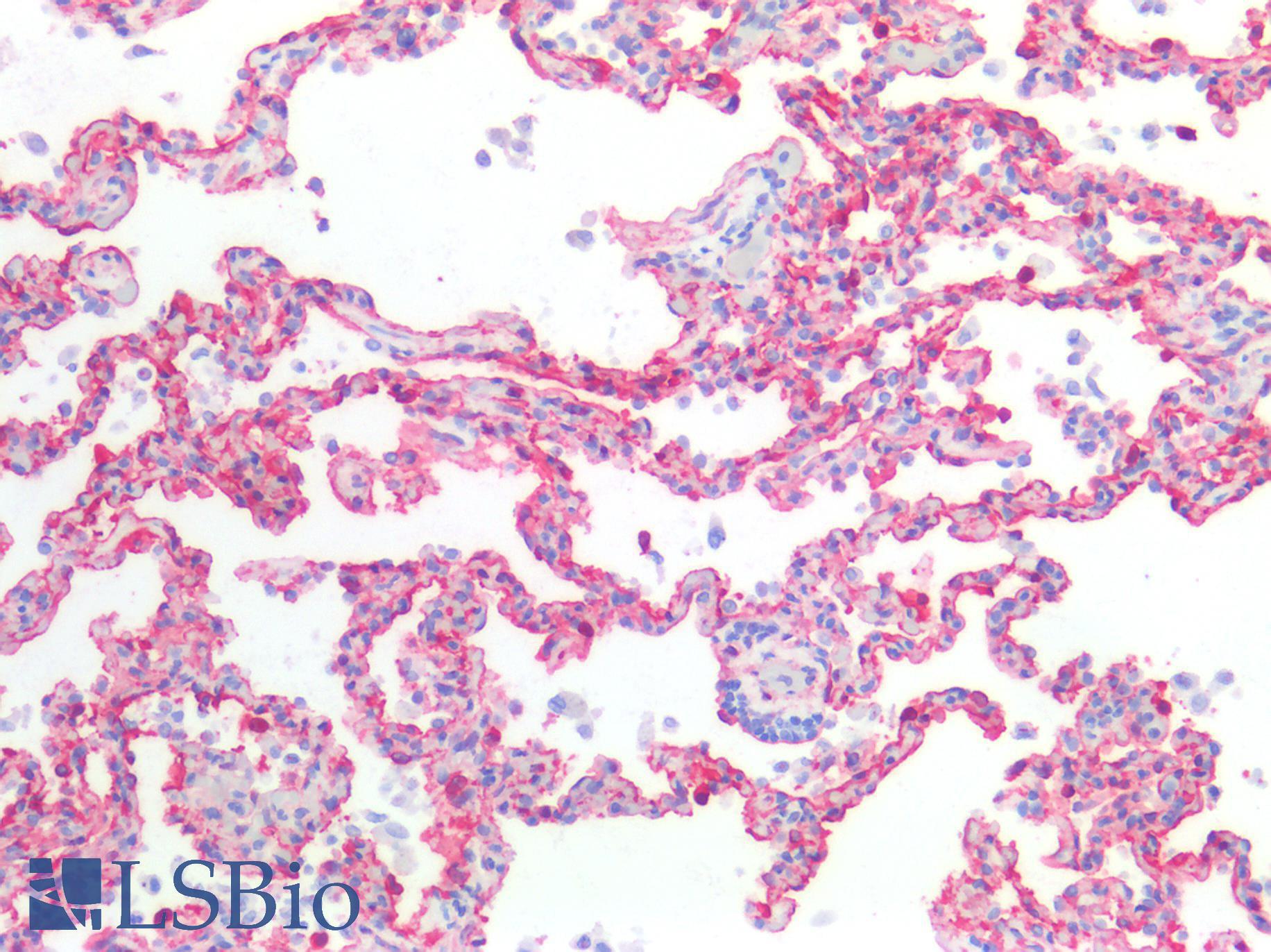 CAV1 / Caveolin 1 Antibody - Human Lung: Formalin-Fixed, Paraffin-Embedded (FFPE)