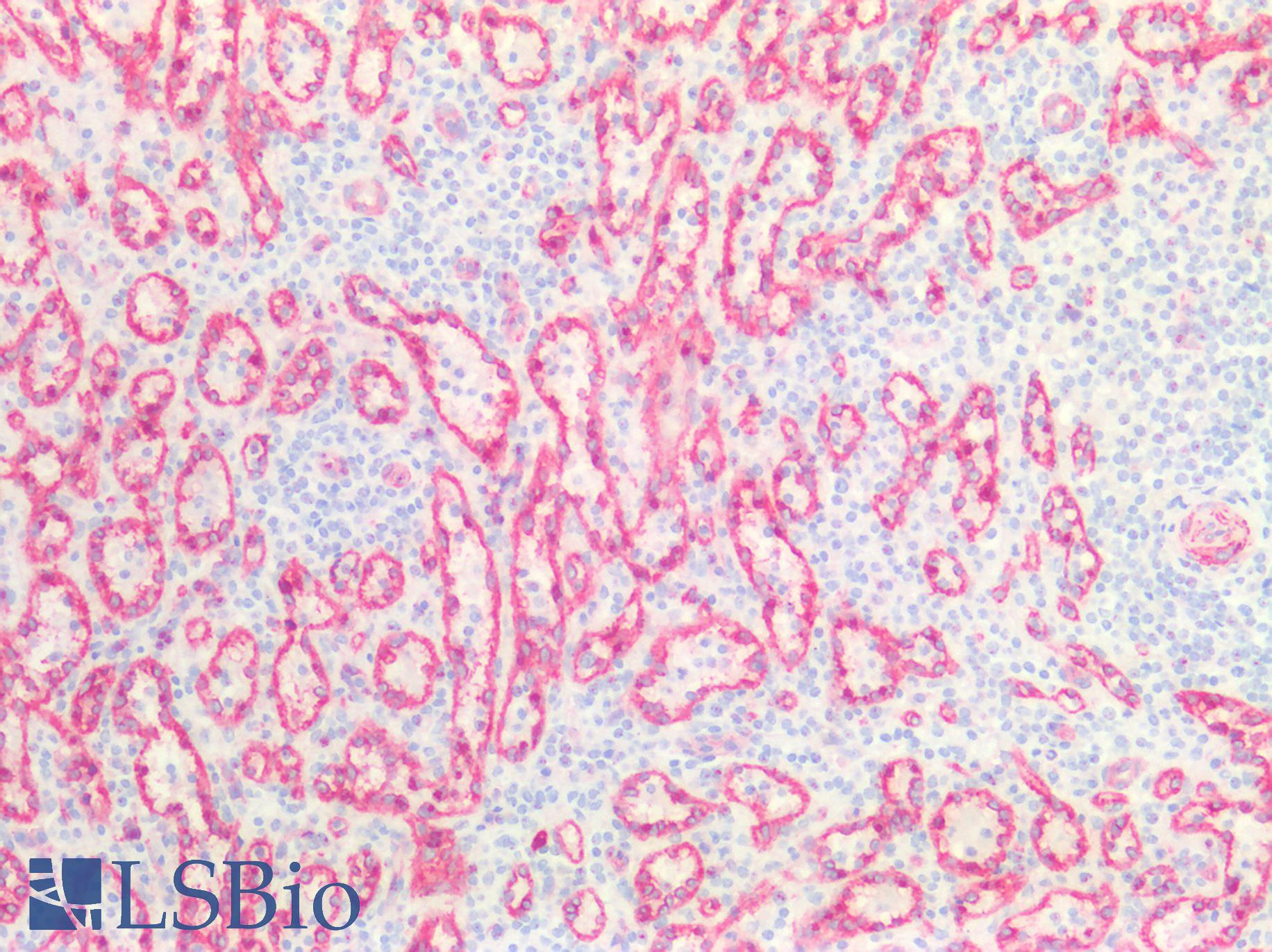 CAV1 / Caveolin 1 Antibody - Human Spleen: Formalin-Fixed, Paraffin-Embedded (FFPE)