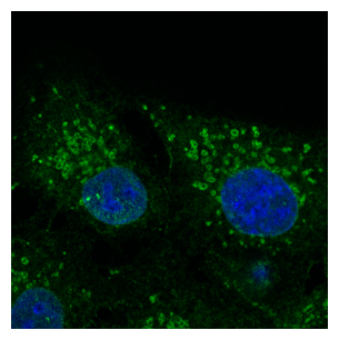 CAV2 / Caveolin 2 Antibody - Immunofluorescence - anti-CAV2 Ab - Caveolae Marker at 1:100 dilution in NHI:3T3 cells; cells were fixed with methanol and permeabilized with 0.1% saponin;
