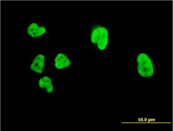 CBFA1 / RUNX2 Antibody - Immunofluorescence of monoclonal antibody to RUNX2 on HeLa cell (antibody concentration 10 ug/ml).