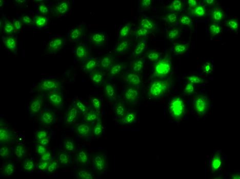 CBFA2T2 / MTGR1 Antibody - Immunofluorescence analysis of U20S cell using CBFA2T2 antibody.
