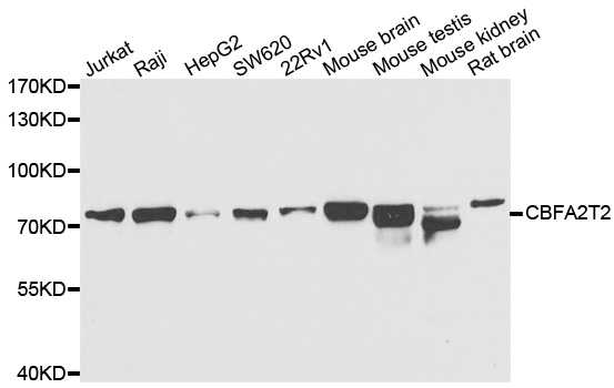 CBFA2T2 / MTGR1 Antibody - Western blot analysis of extracts of various cell lines.