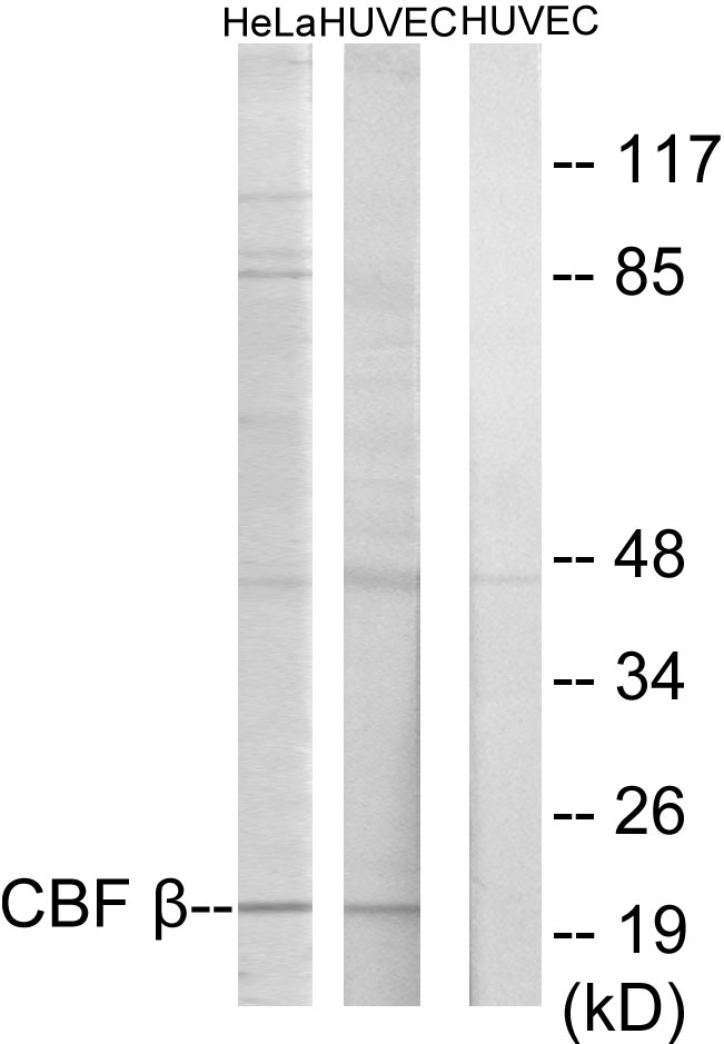 CBFB Antibody - Western blot analysis of lysates from HUVEC and HeLa cells, using CBF beta Antibody. The lane on the right is blocked with the synthesized peptide.