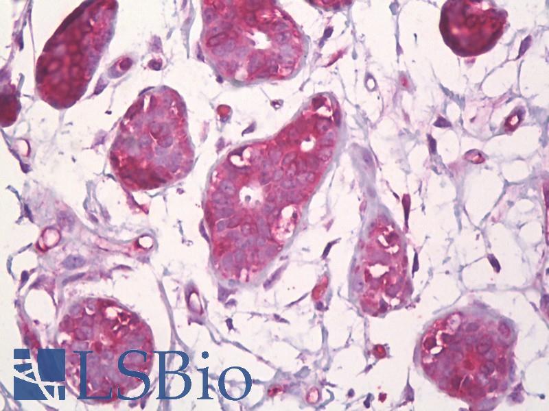 CBFB Antibody - Anti-CBFB antibody IHC of human breast, epithelium. Immunohistochemistry of formalin-fixed, paraffin-embedded tissue after heat-induced antigen retrieval. Antibody dilution 1:100.