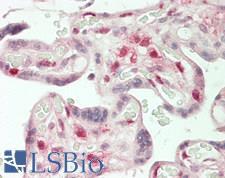 CBLB Antibody - Human Placenta: Formalin-Fixed, Paraffin-Embedded (FFPE)