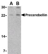 CBLN1 / Cerebellin 1 Antibody - Western blot of precerebellin in mouse cerebellum lysate with CBLN1 / Cerebellin 1 Antibody at (A) 2 and (B) 4 ug/ml.