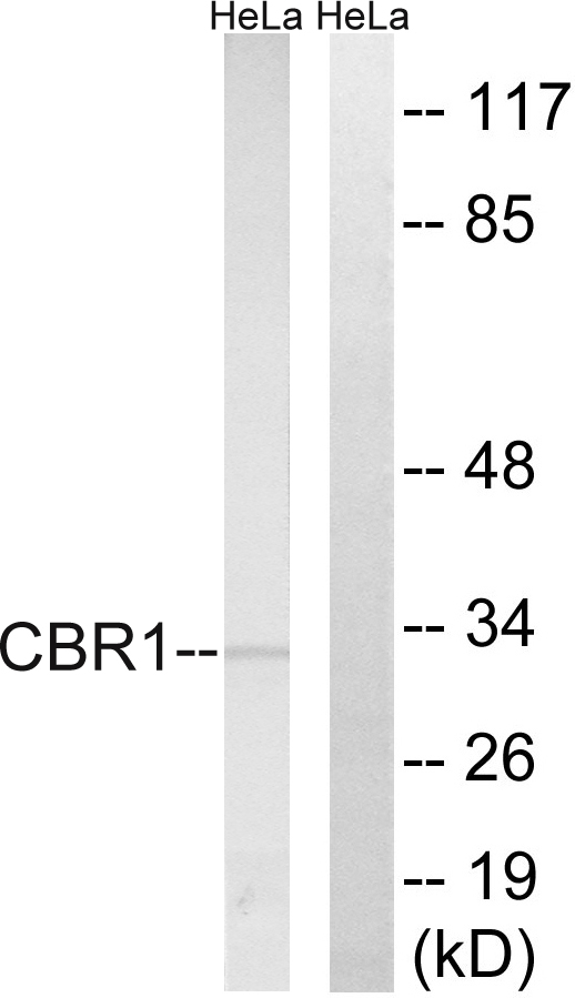 CBR / CBR1 Antibody - Western blot analysis of lysates from HeLa cells, using CBR1 Antibody. The lane on the right is blocked with the synthesized peptide.