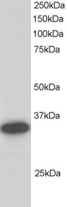 CBR / CBR1 Antibody - Antibody staining (0.2 ug/ml) of Human Liver lysate (RIPA buffer, 30 ug total protein per lane). Primary incubated for 1 hour. Detected by Western blot of chemiluminescence.