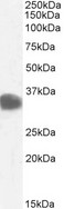 CBR / CBR1 Antibody - CBR / CBR1 antibody (0.1µg/ml) staining of Human Kidney lysate (35µg protein in RIPA buffer). Detected by chemiluminescence.