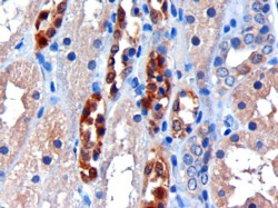 CBR / CBR1 Antibody - CBR / CBR1 antibody (3µg/ml) staining of paraffin embedded Human Kidney. Microwaved antigen retrieval with citrate buffer pH 6, HRP-staining.