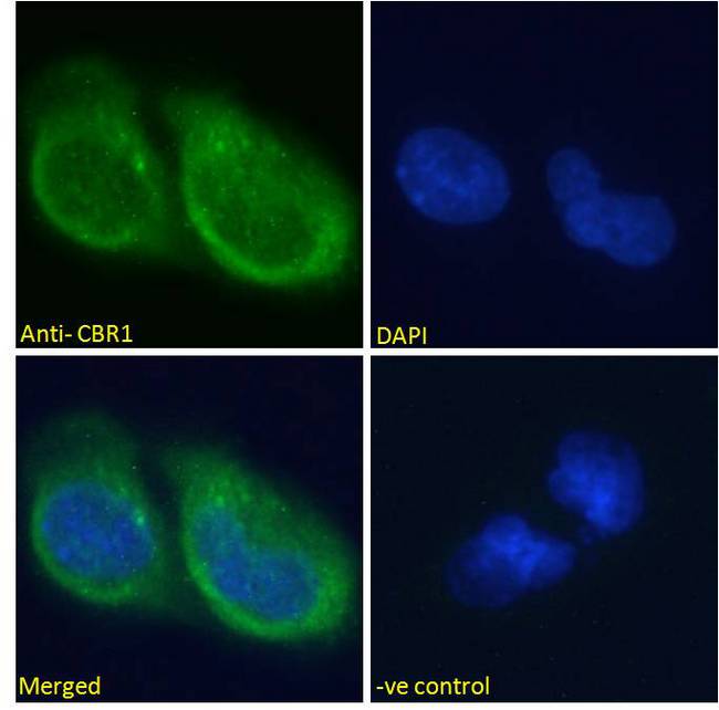 CBR / CBR1 Antibody - CBR1 Antibody Immunofluorescence analysis of paraformaldehyde fixed U251 cells, permeabilized with 0.15% Triton. Primary incubation 1hr (10ug/ml) followed by Alexa Fluor 488 secondary antibody (2ug/ml), showing cytoplasmic staining. The nuclear stain is DAPI (blue). Negative control: Unimmunized goat IgG (10ug/ml) followed by Alexa Fluor 488 secondary antibody (2ug/ml).