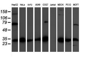 CBR3 Antibody - Western blot of extracts (35 ug) from 9 different cell lines by using anti-CBR3 monoclonal antibody.