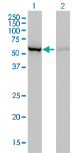 CBS Antibody - Western blot of CBS expression in transfected 293T cell line. Lane 1: CBS transfected lysate (61 KDa). Lane 2: Non-transfected lysate.