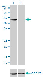 CBS Antibody - Western blot of CBS over-expressed 293 cell line, cotransfected with CBS Validated Chimera RNAi (Lane 2) or non-transfected control (Lane 1). Blot probed with CBS antibody, clone 3E1. GAPDH ( 36.1 kD ) used as specificity and loading control.