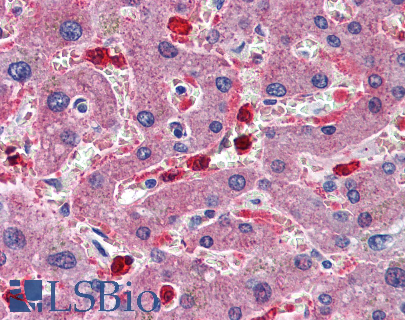 CBS Antibody - Anti-CBS antibody IHC of human liver. Immunohistochemistry of formalin-fixed, paraffin-embedded tissue after heat-induced antigen retrieval. Antibody concentration 5 ug/ml.