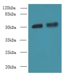 CBX2 Antibody - Western blot. All lanes: CBX2 antibody at 6 ug/ml. Lane 1: A431 whole cell lysate. Lane 2: Mouse heart tissue. Secondary Goat polyclonal to Rabbit IgG at 1:10000 dilution. Predicted band size: 56 kDa. Observed band size: 56 kDa.