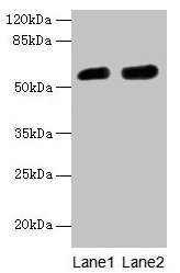 CBX2 Antibody - Western blot All lanes: CBX2 antibody at 6µg/ml Lane 1: A431 whole cell lysate Lane 2: Mouse heart tissue Secondary Goat polyclonal to rabbit IgG at 1/10000 dilution Predicted band size: 57, 24 kDa Observed band size: 57 kDa