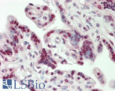 CBX3 / HP1 Gamma Antibody - Human Placenta: Formalin-Fixed, Paraffin-Embedded (FFPE)