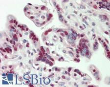 CBX3 / HP1 Gamma Antibody - Human Placenta: Formalin-Fixed, Paraffin-Embedded (FFPE)