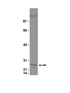 CBX3 / HP1 Gamma Antibody - WB: HeLa nuclear extract was probed with Anti-HP1 Gamma.
