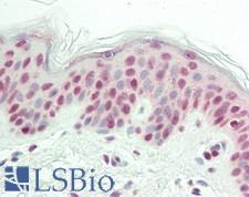 CBX3 / HP1 Gamma Antibody - Human Skin: Formalin-Fixed, Paraffin-Embedded (FFPE)