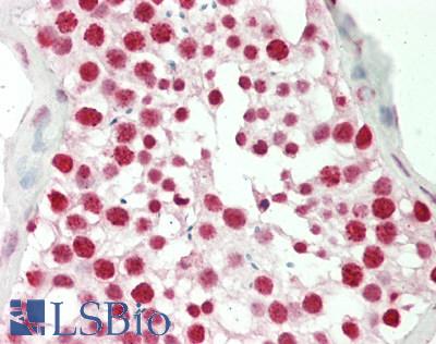 CBX3 / HP1 Gamma Antibody - Human Testis: Formalin-Fixed, Paraffin-Embedded (FFPE)