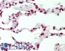 CBX4 Antibody - Human Lung: Formalin-Fixed, Paraffin-Embedded (FFPE)